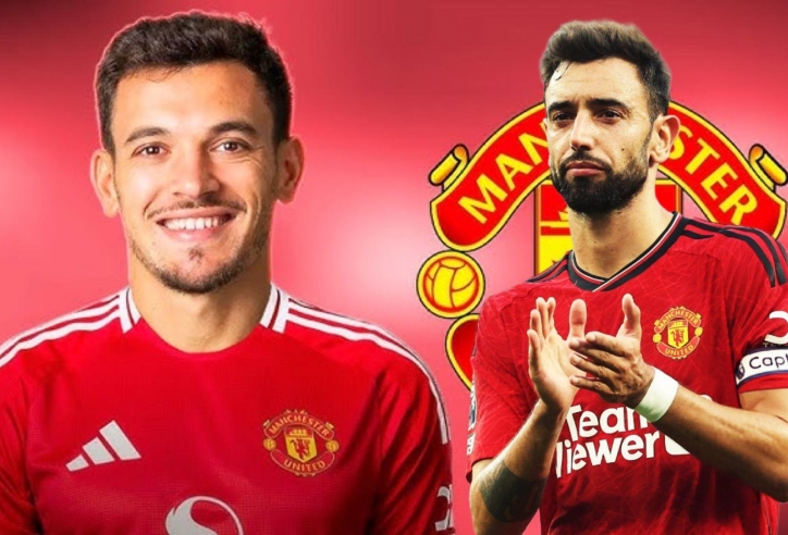 Những thay đổi tại Manchester United